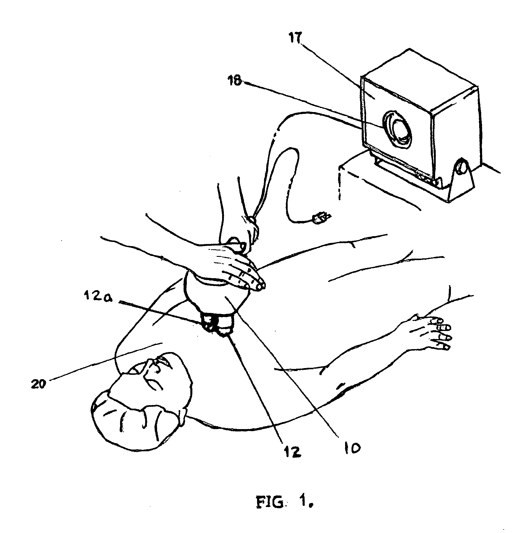 Percussion assisted angiogenesis