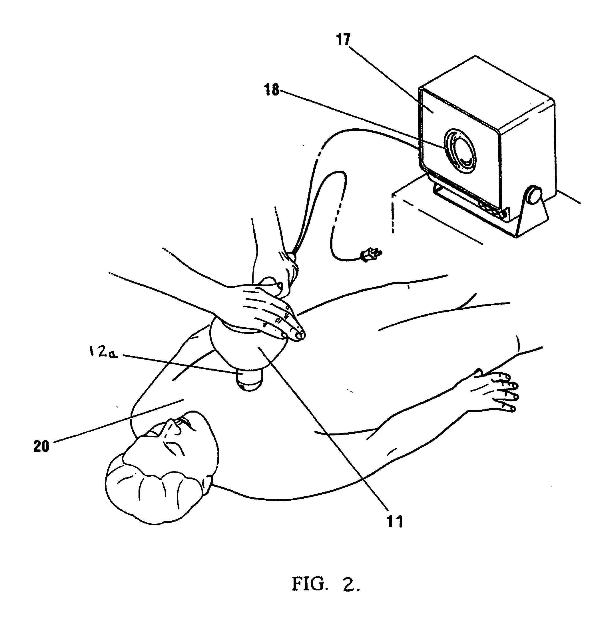 Percussion assisted angiogenesis