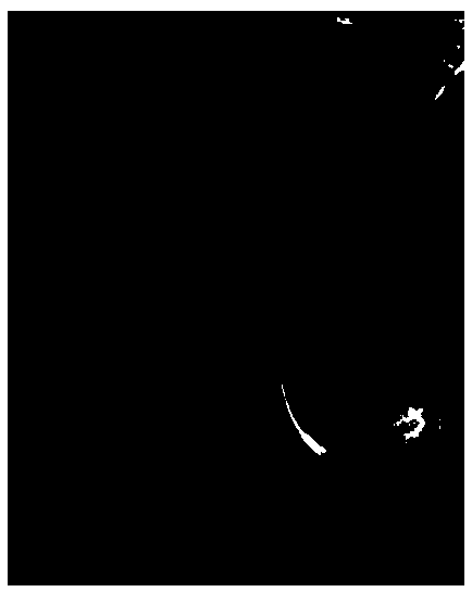 Method and device for recognizing nidi through breast images