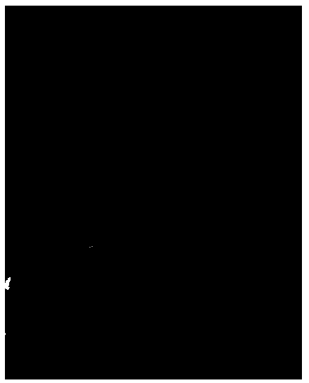 Method and device for recognizing nidi through breast images