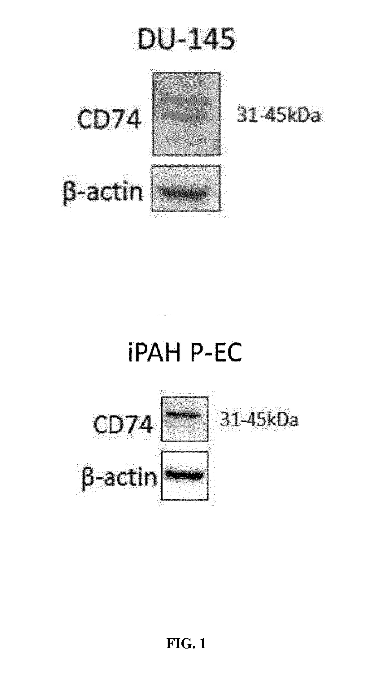 Mif inhibitors for the acute or chronic treatment of pulmonary hypertension