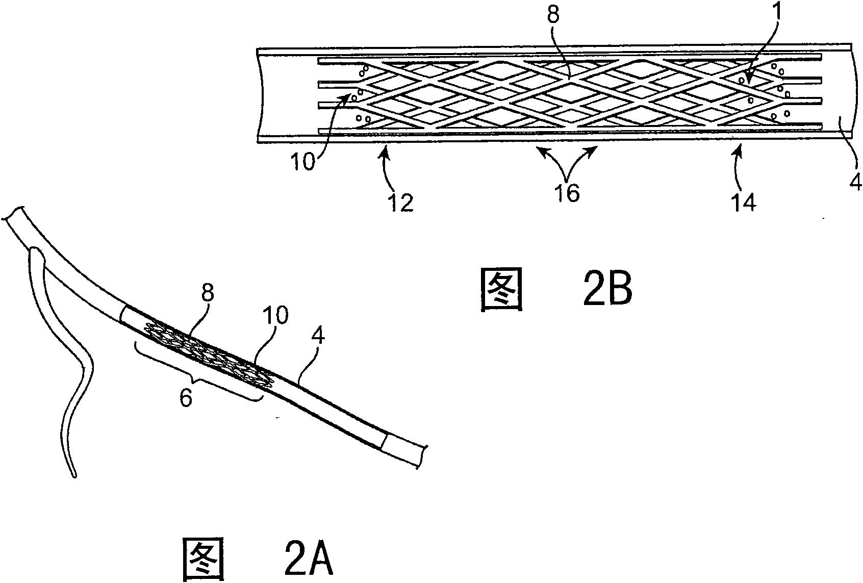 Stent systems