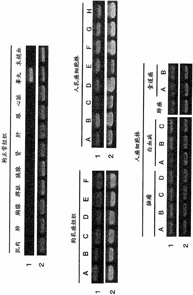 Pharmaceutical composition for treatment and/or prevention of cancer