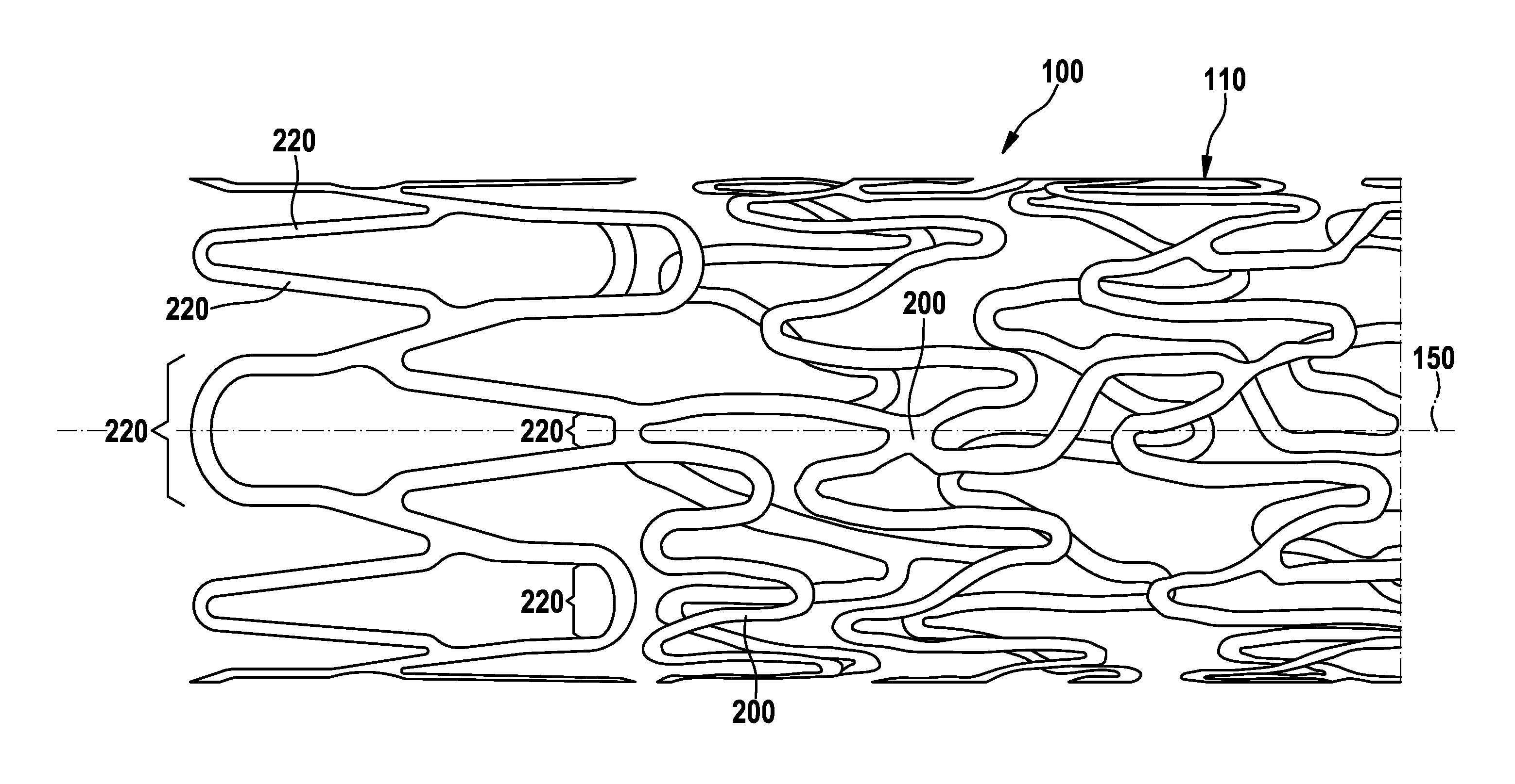 Stent and Method and Device for Fabricating the Stent