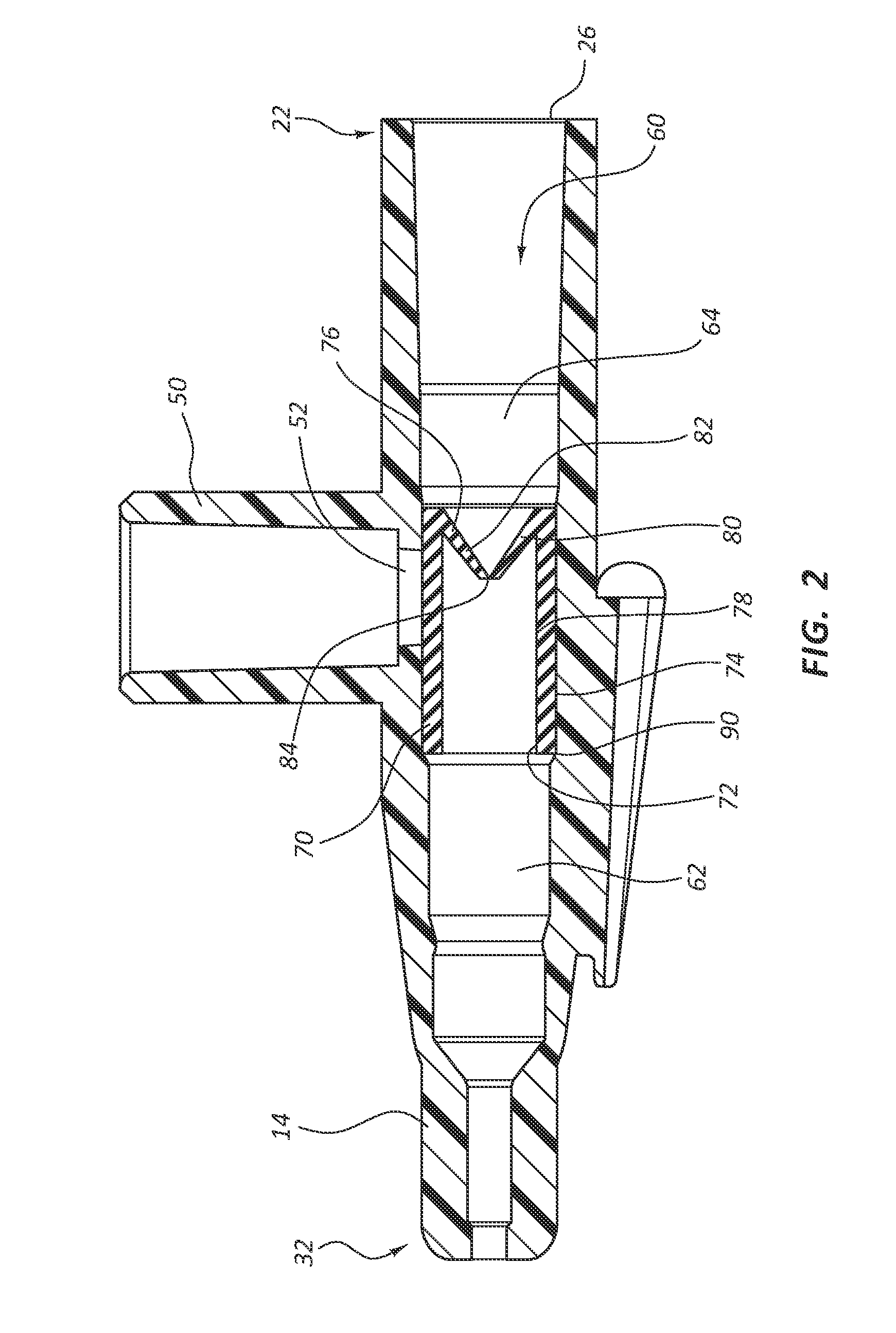 Intravenous catheter with duckbill valve