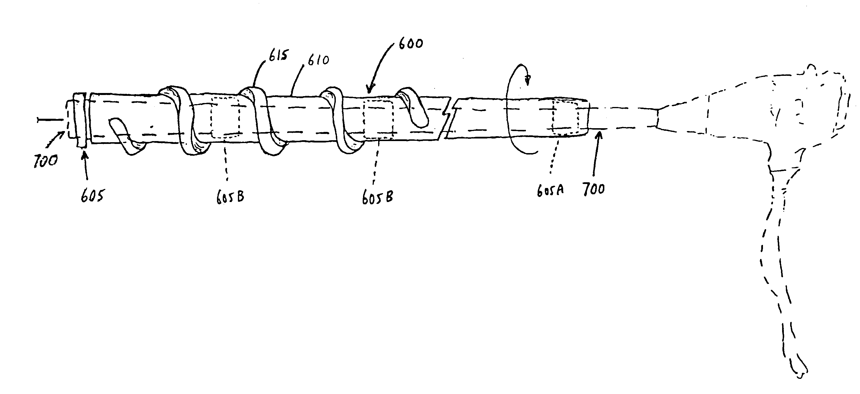 Rotate-to-advance catheterization system