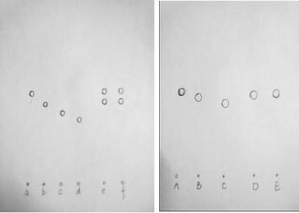 Application of sargassan to preparation of medicament for preventing and treating urinary calculus