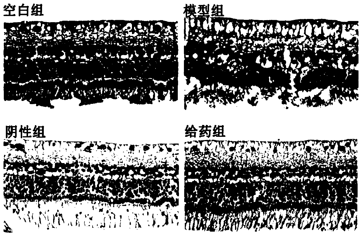 Application of notoginsenoside extract in preparation of medicinal preparation for eyes