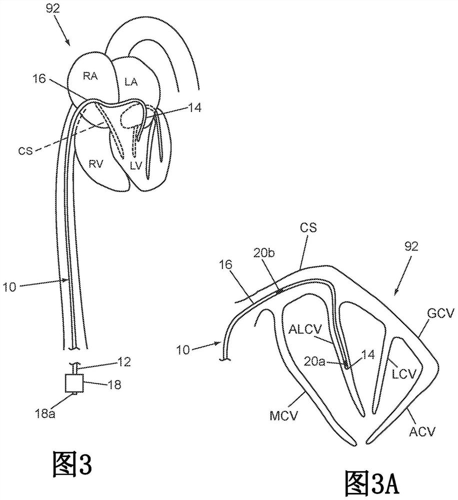 Devices, systems, and methods for improving the accuracy and utility of imaging for cardiovascular procedures