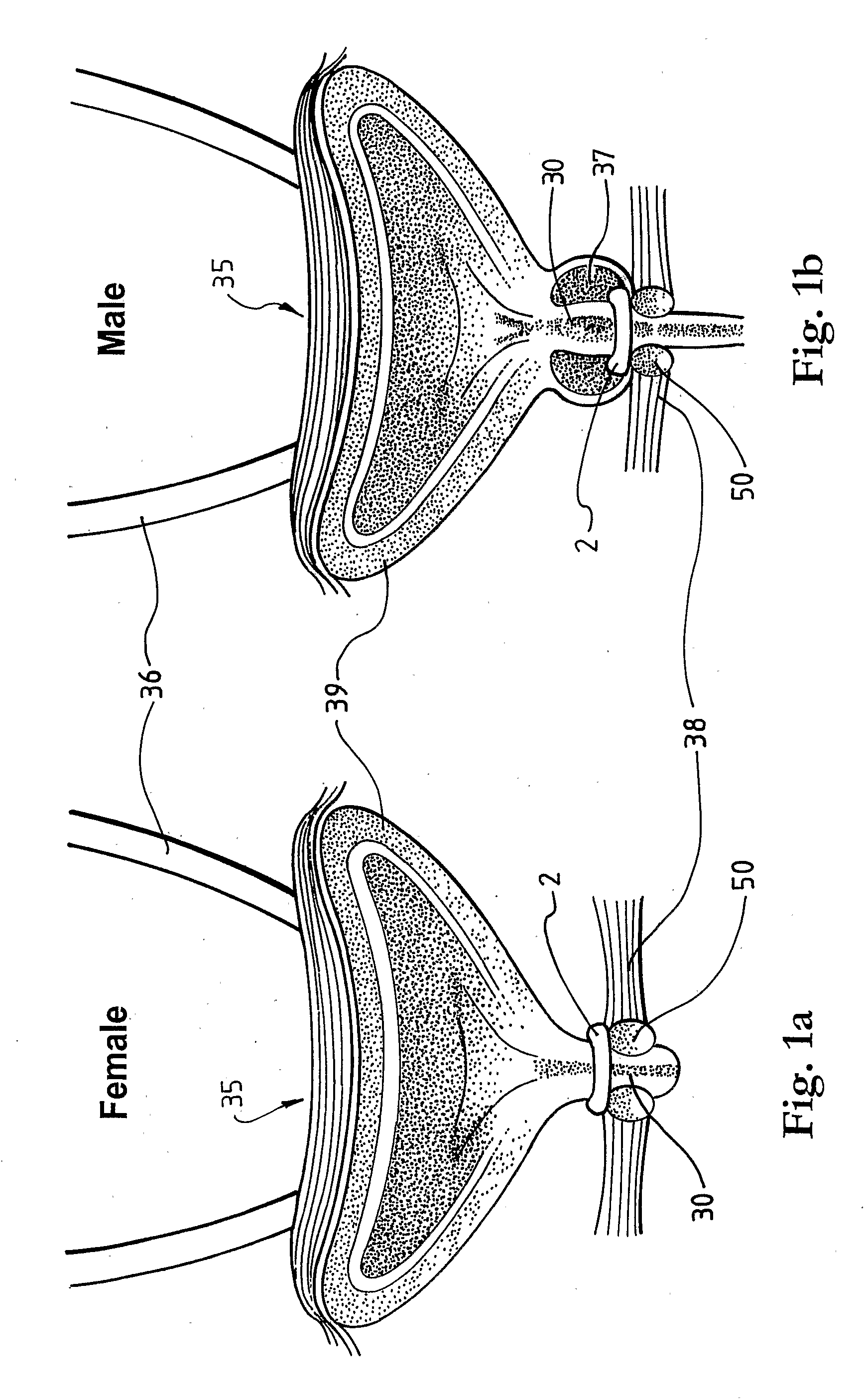 Method and Apparatus for Treating Incontinence