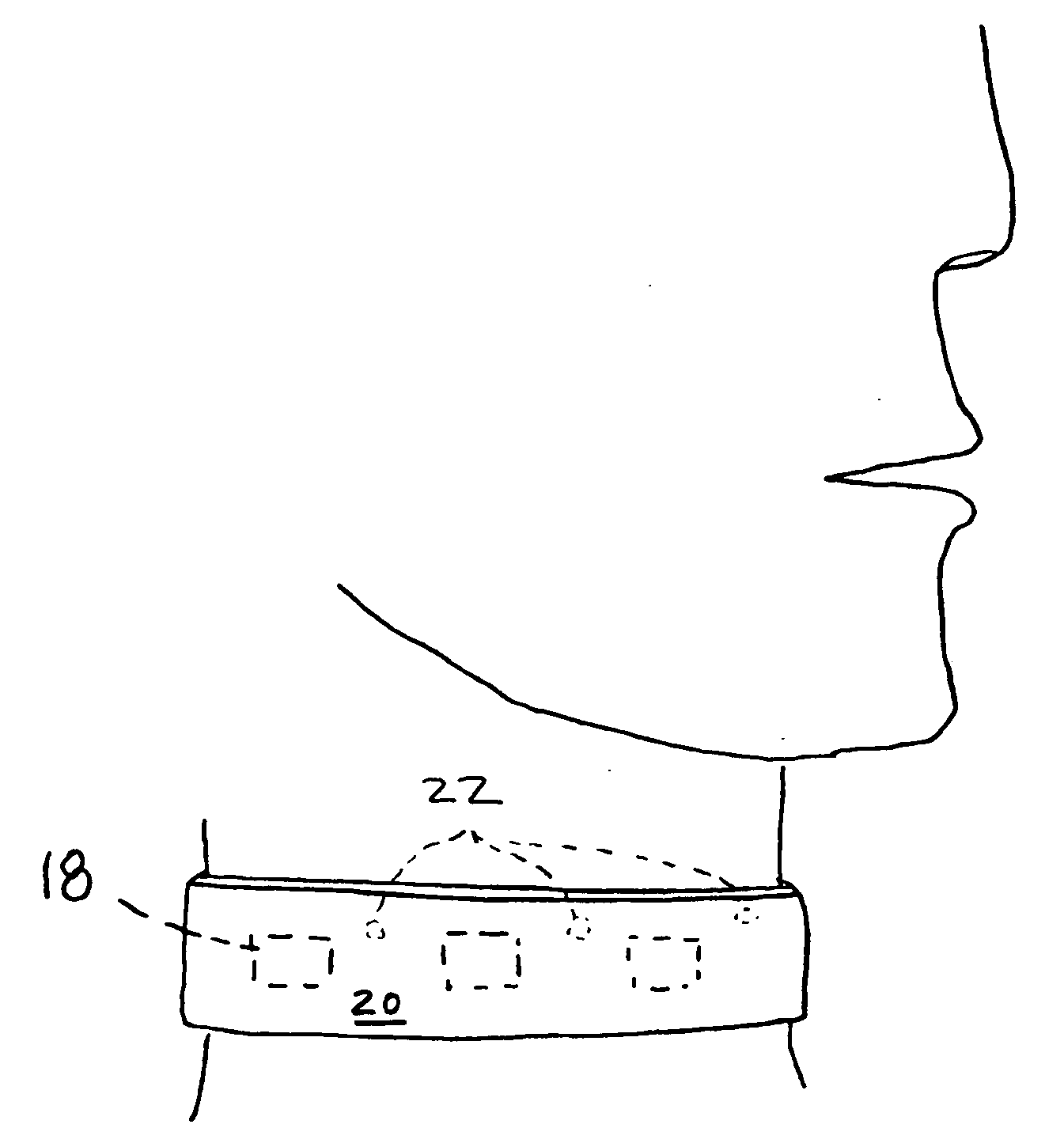 Medical device for restoration of autonomic and immune functions impaired by neuropathy