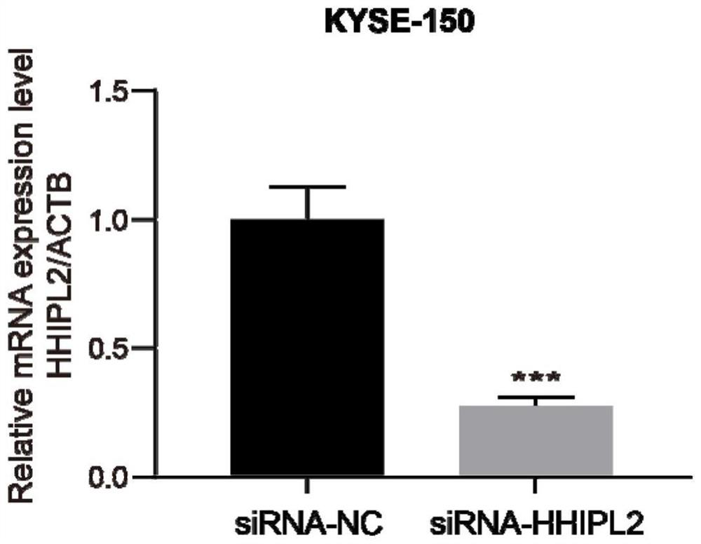 Application of human HHIPL2 mRNA in targeted therapy and prognosis evaluation of esophageal squamous cell carcinoma and kit