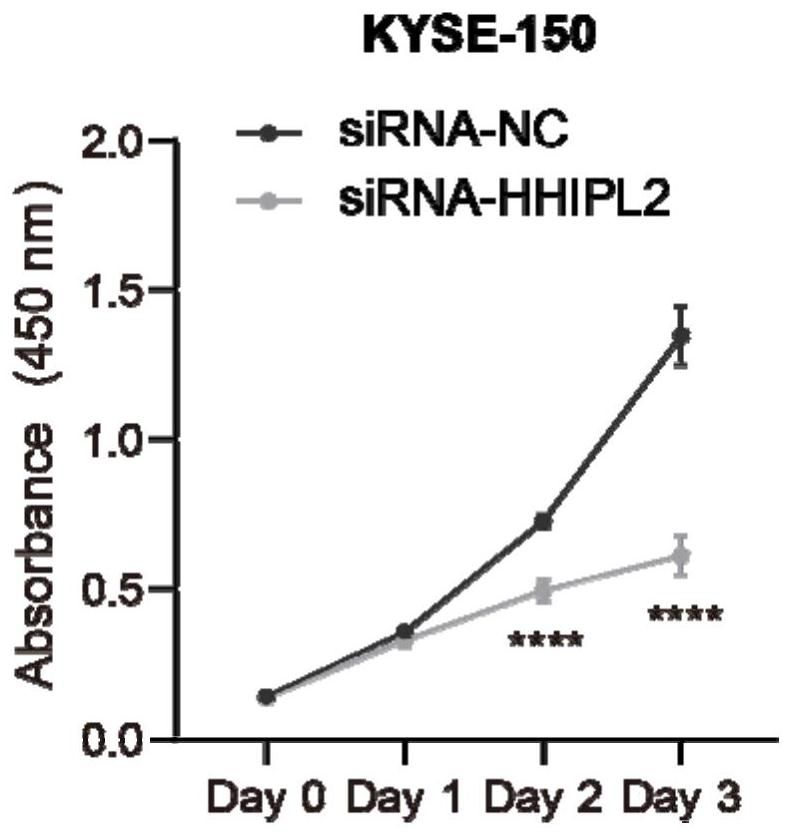 Application of human HHIPL2 mRNA in targeted therapy and prognosis evaluation of esophageal squamous cell carcinoma and kit