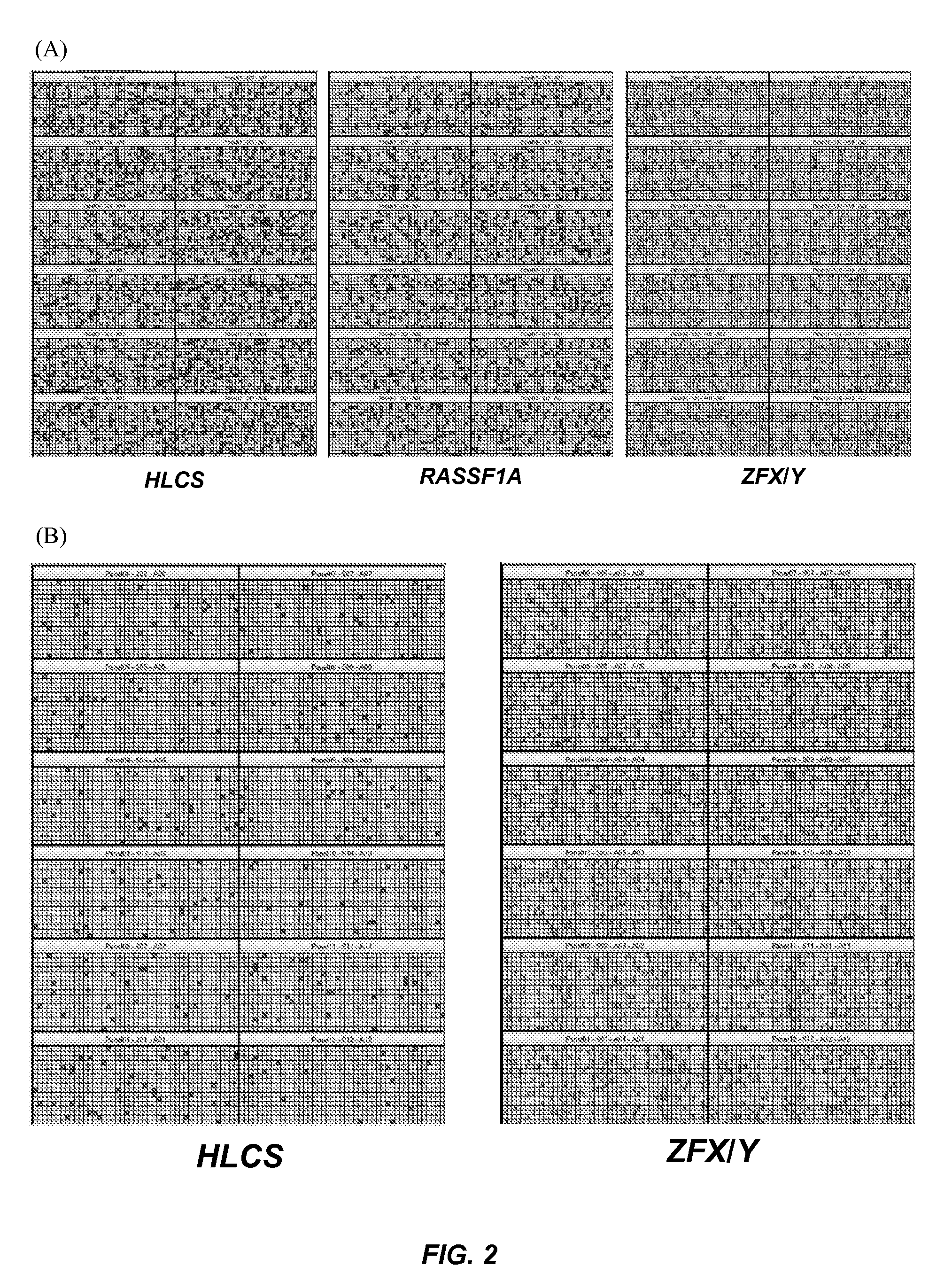 Method for detecting chromosomal aneuploidy