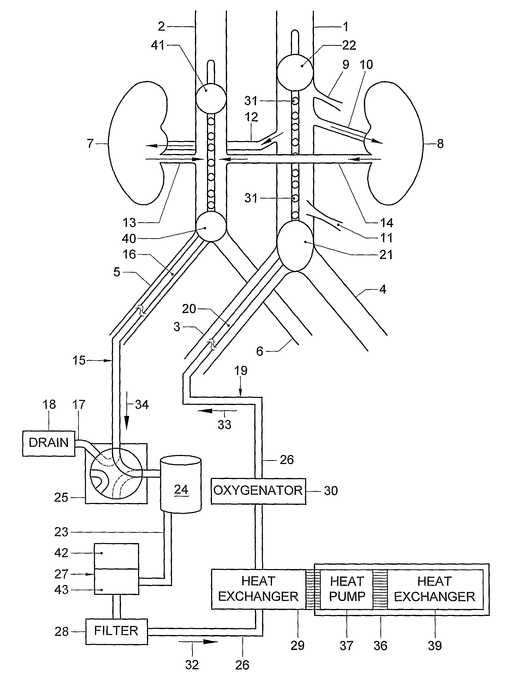 Method and a system for prolongation of the viability of a donor organ