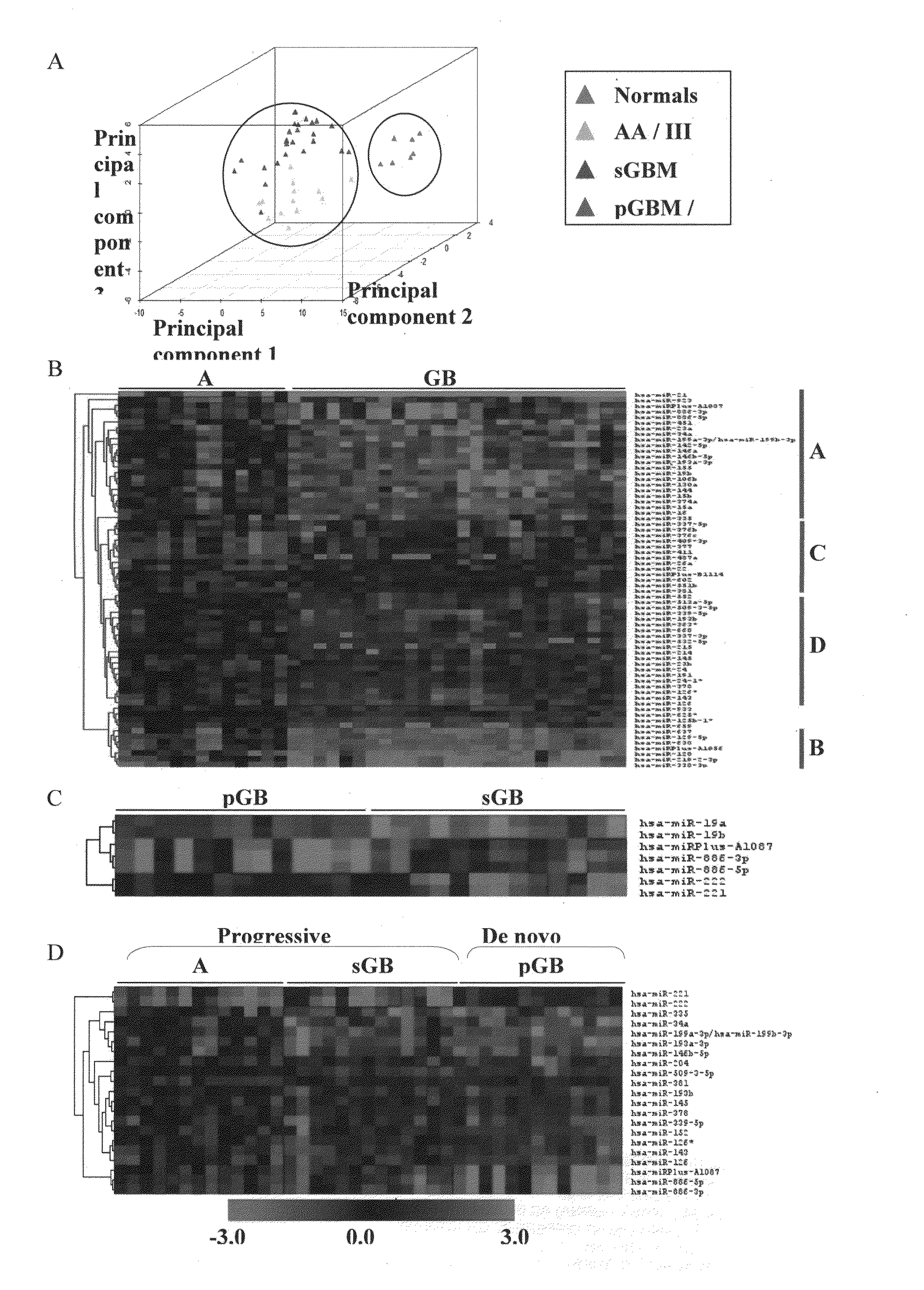 MicroRNAa (miRNA) AS BIOMARKERS FOR DIAGNOSING DIFFERENT GRADES OF GLIOMAS AND PATHWAYS OF GLIOMA PROGRESSION