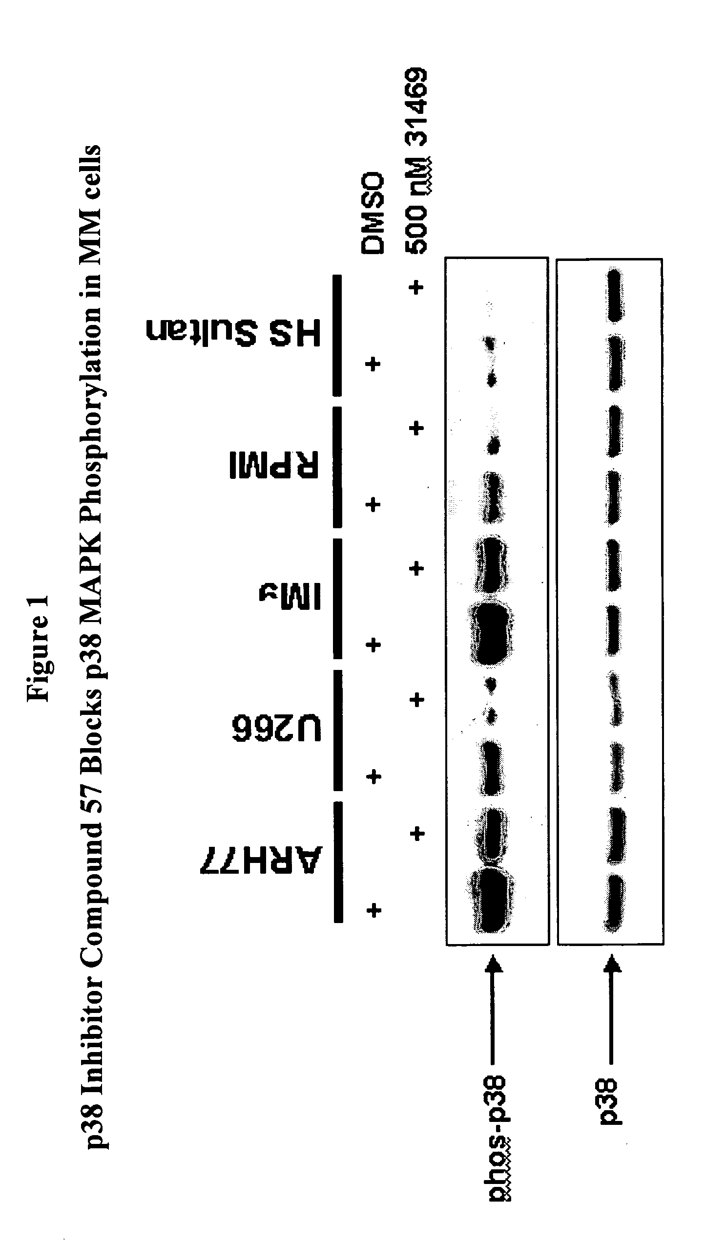 Treatment of multiple myeloma by p38 MAP kinase and proteasome inhibition