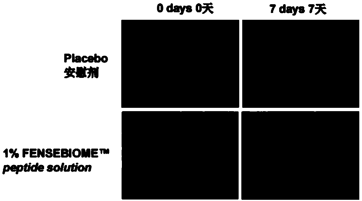 Skin micro-ecology balance composite and application thereof