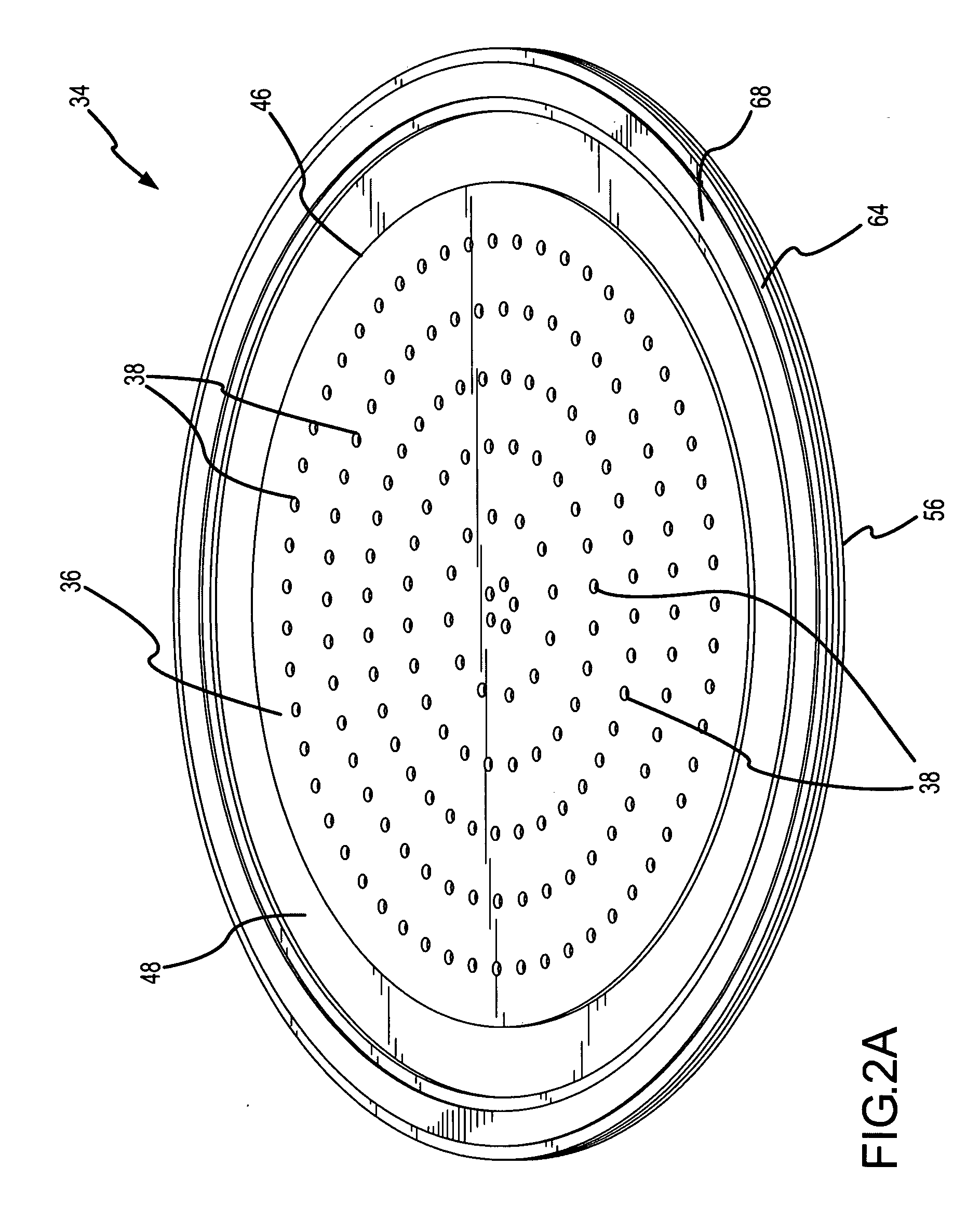 Glaucoma implant having MEMS flow module with flexing diaphragm for pressure regulation