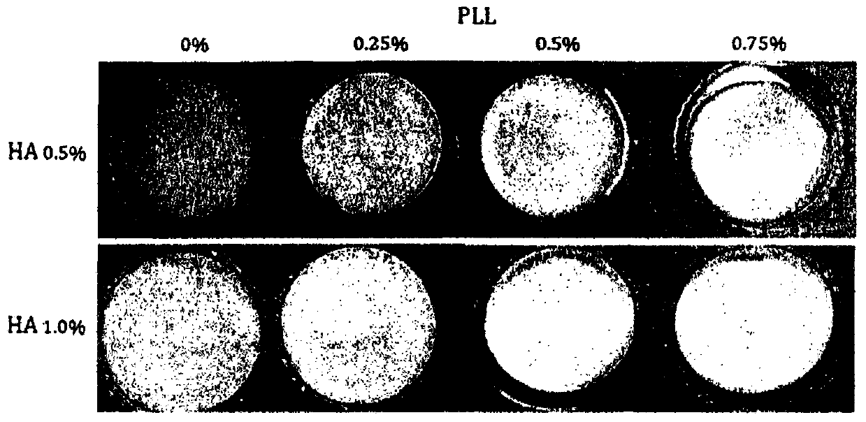 Wound dressing comprising hyaluronic acid-calcium and polylysine and manufacturing method therefor