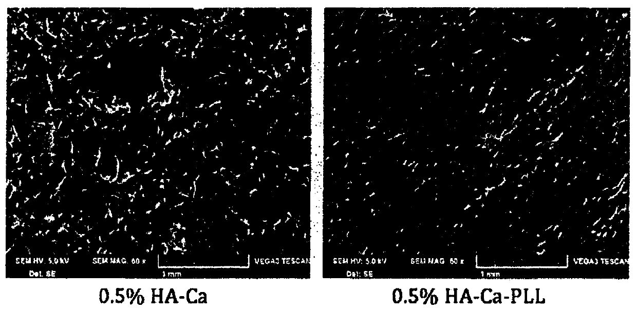 Wound dressing comprising hyaluronic acid-calcium and polylysine and manufacturing method therefor