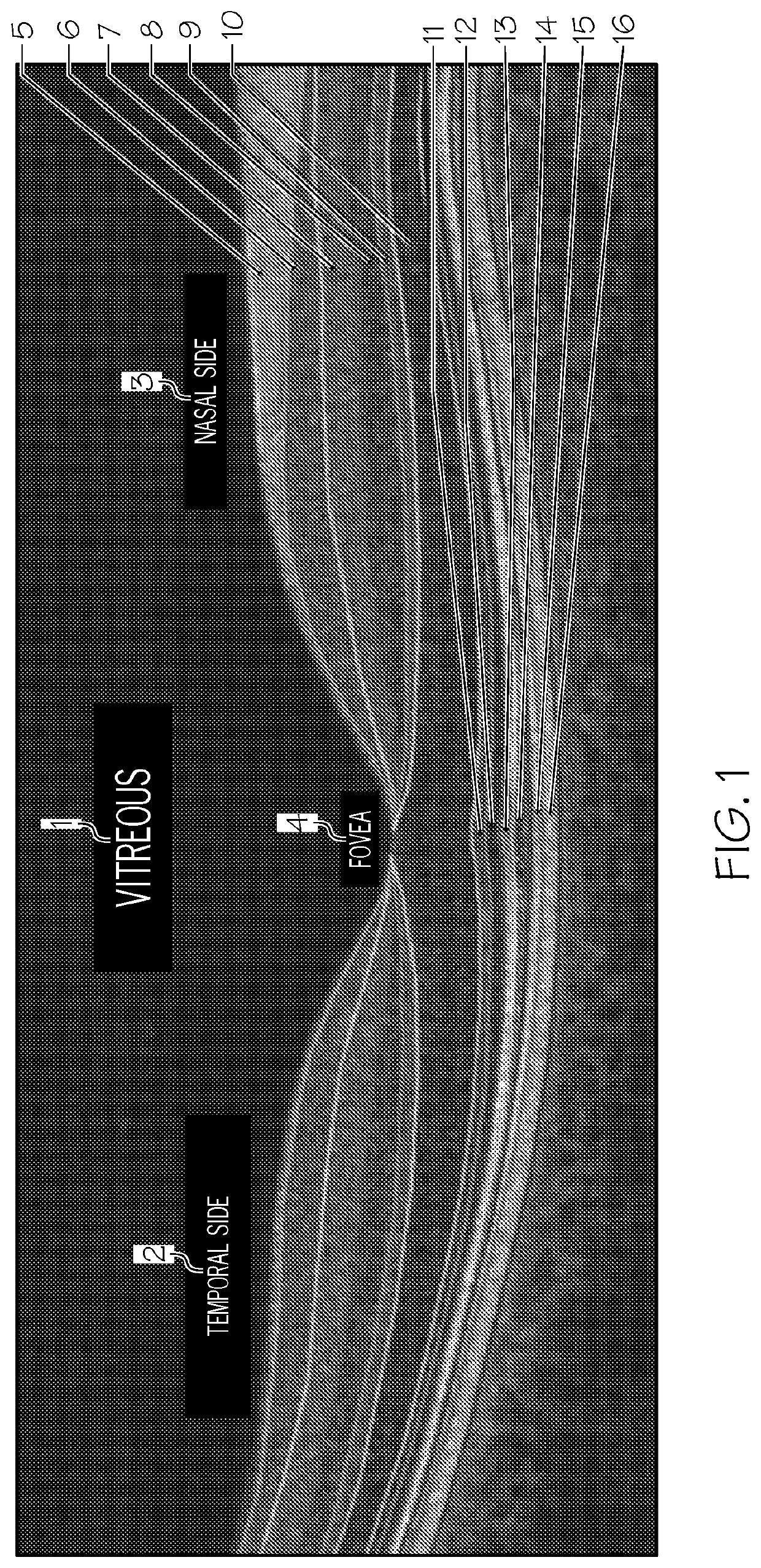 Automated methods for the objective quantification of retinal characteristics by retinal region and diagnosis of retinal pathology