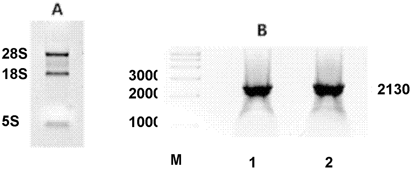 Wild type and mutant hFIX (human coagulation factor IX) Pichia pastoris expression vectors, and construction method and application thereof