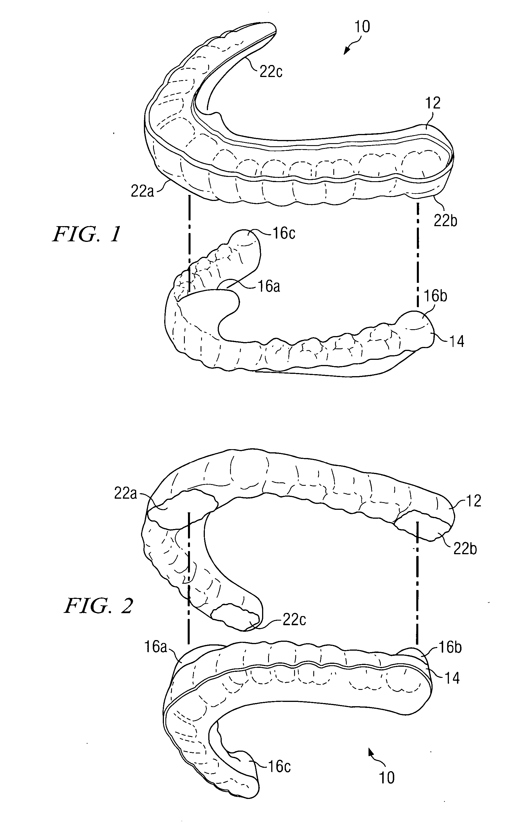 Oral appliance for maintaining stability of one or more aspects of a user's masticatory system