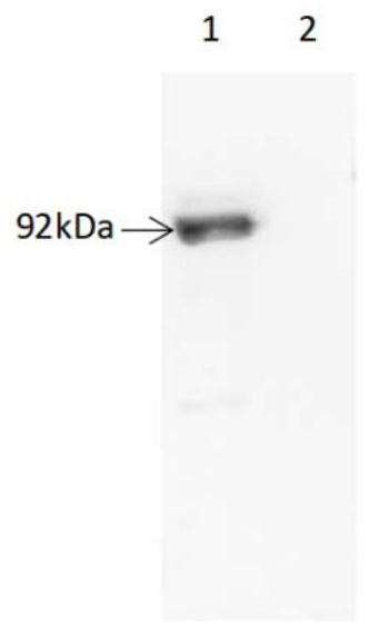 African swine fever virus vaccine and preparation method thereof