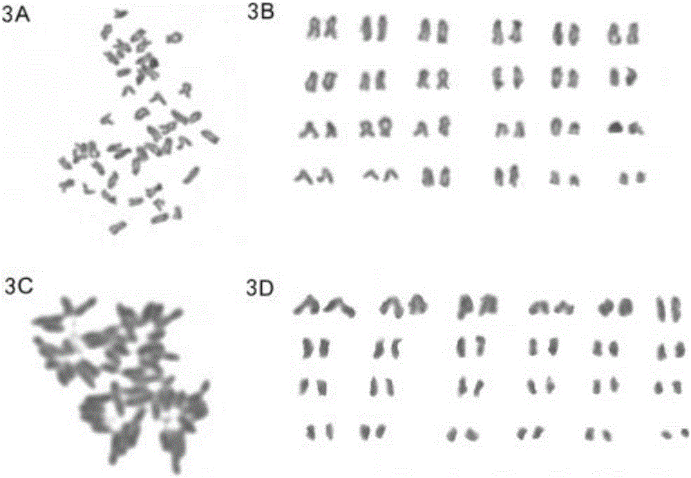 Construction method for normal and whitening skin cell line of bastard halibut