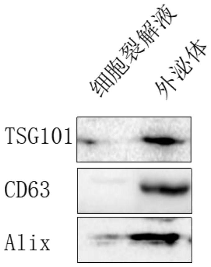 Lung-targeted drug-loaded exosome, application and medicine for treating lung diseases