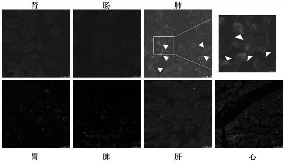 Lung-targeted drug-loaded exosome, application and medicine for treating lung diseases