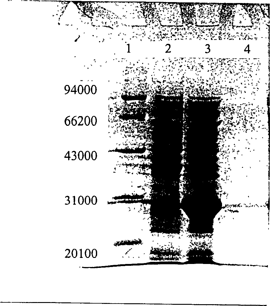 Process for preparing recombinant natookinase