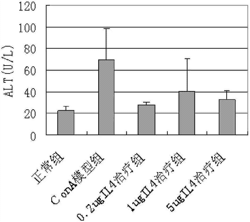 Uses of IL-4 in preparing medicament composition for treating chronic hepatic fibrosis