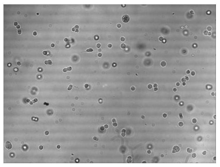 A method for preparing mink parvovirus enteritis antigen protein complex, antigen protein complex and application thereof