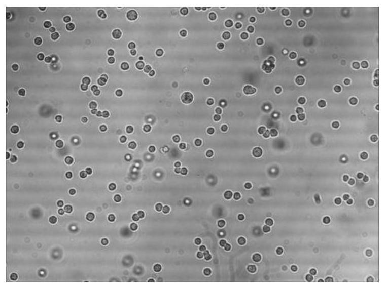 A method for preparing mink parvovirus enteritis antigen protein complex, antigen protein complex and application thereof