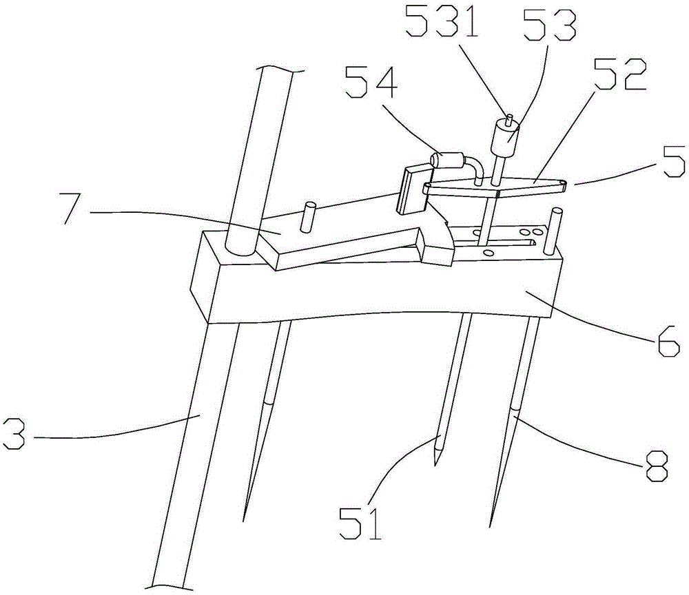 A Hallux Valgus Base Closed Wedge Osteotomy Guide