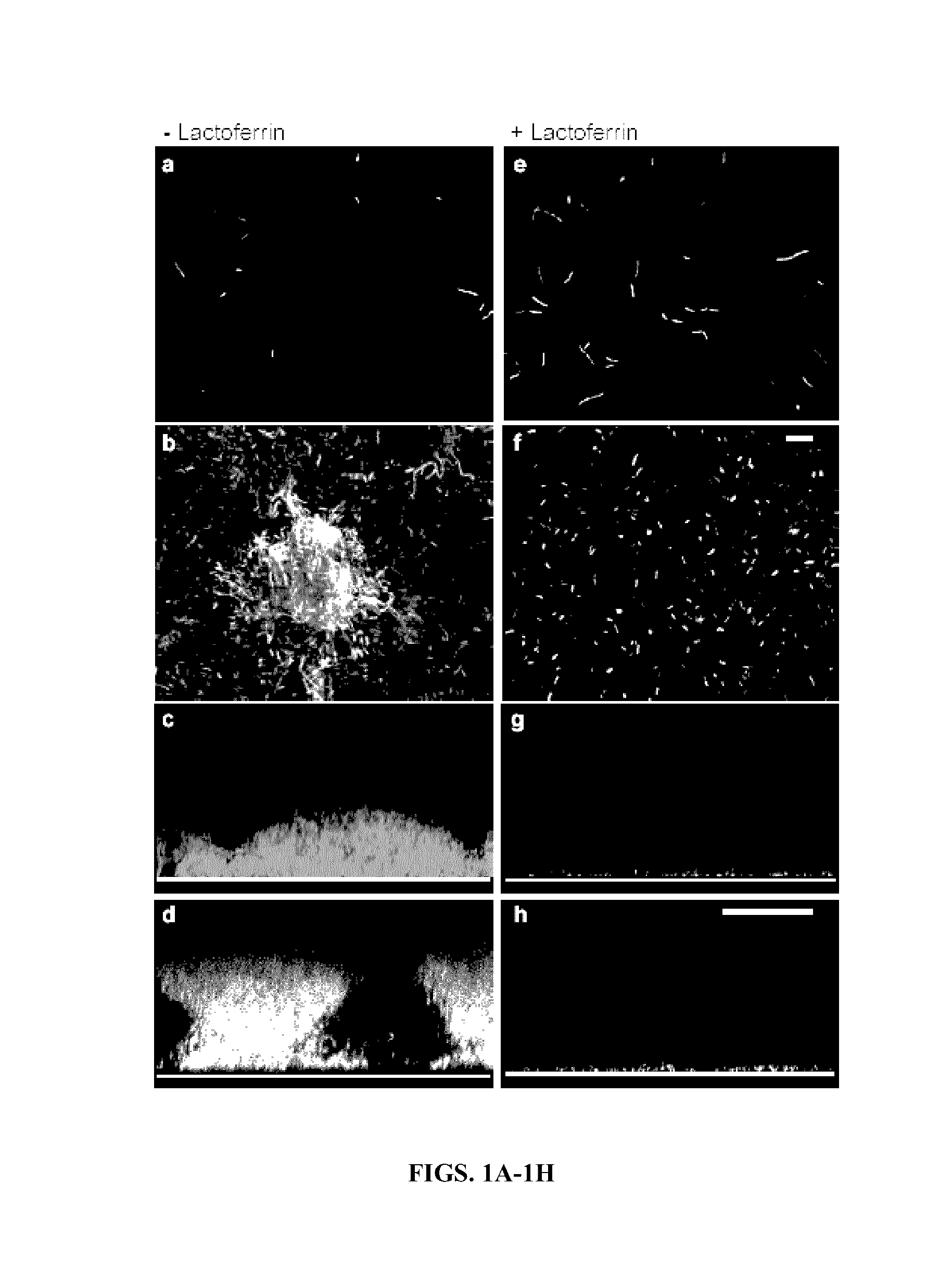 Gallium inhibits biofilm formation