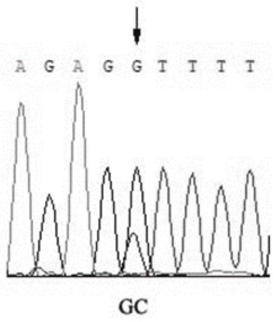 SNP (Single Nucleotide Polymorphism) molecular marker related to egg yield of female pigeons, kit and application of SNP molecular marker