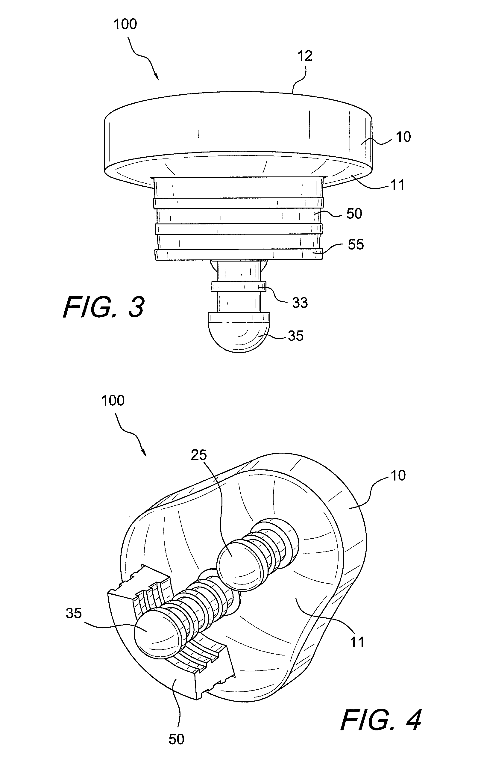 Hybrid glenoid for shoulder arthroplasty