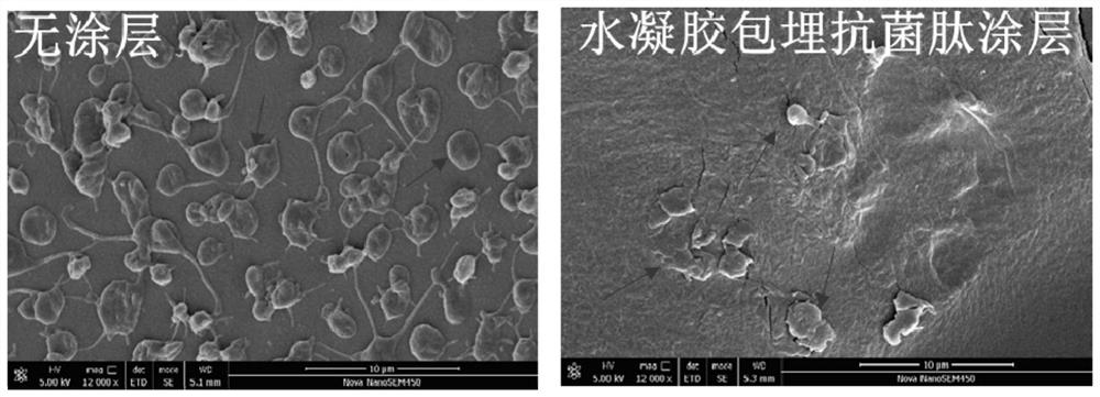 Biomedical coating with excellent long-acting anticoagulation, antibacterial and anti-fouling performances and preparation method thereof