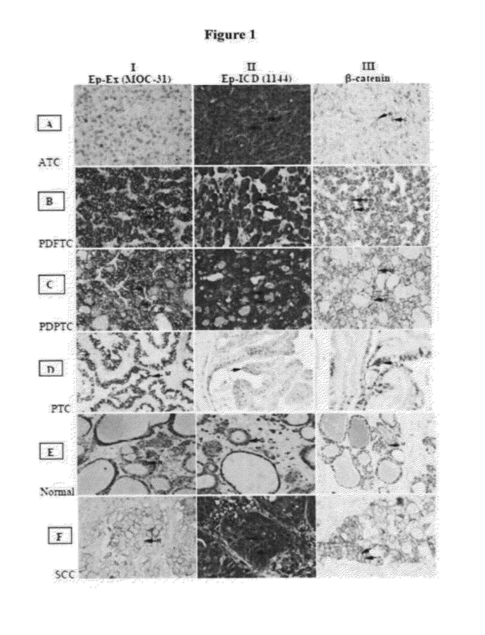 Methods and Compositions for the Diagnosis and Treatment of Thyroid Cancer