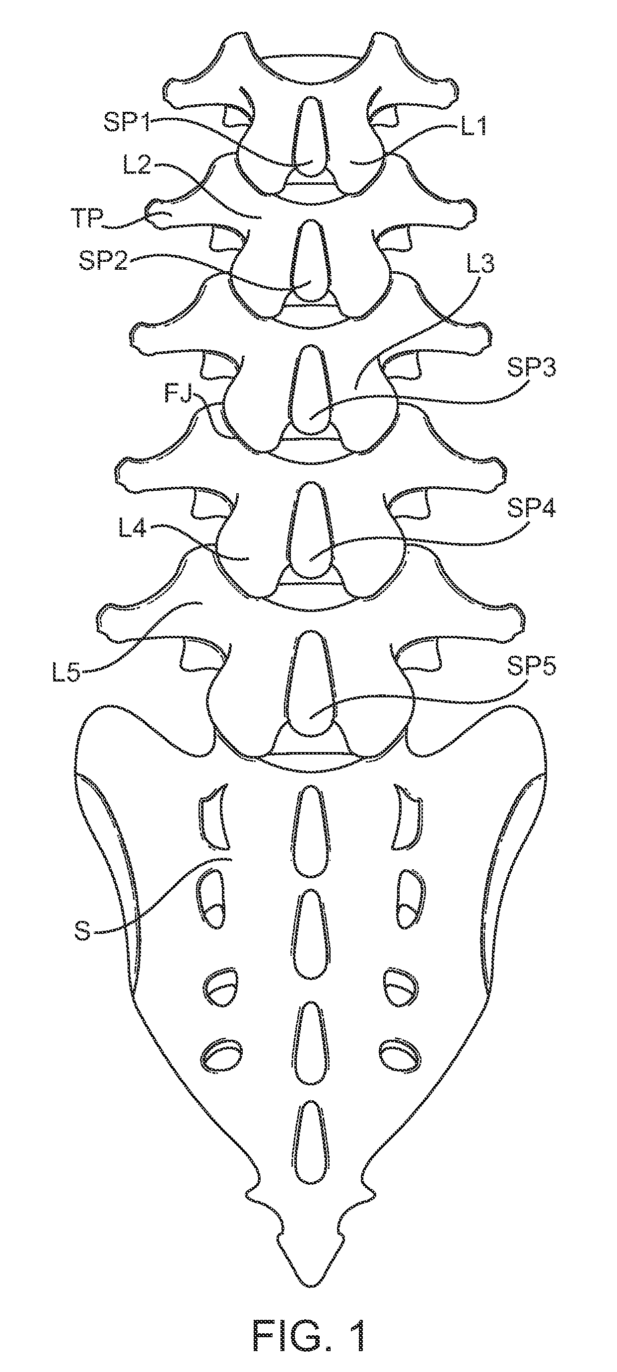 Methods and apparatus for locking a band