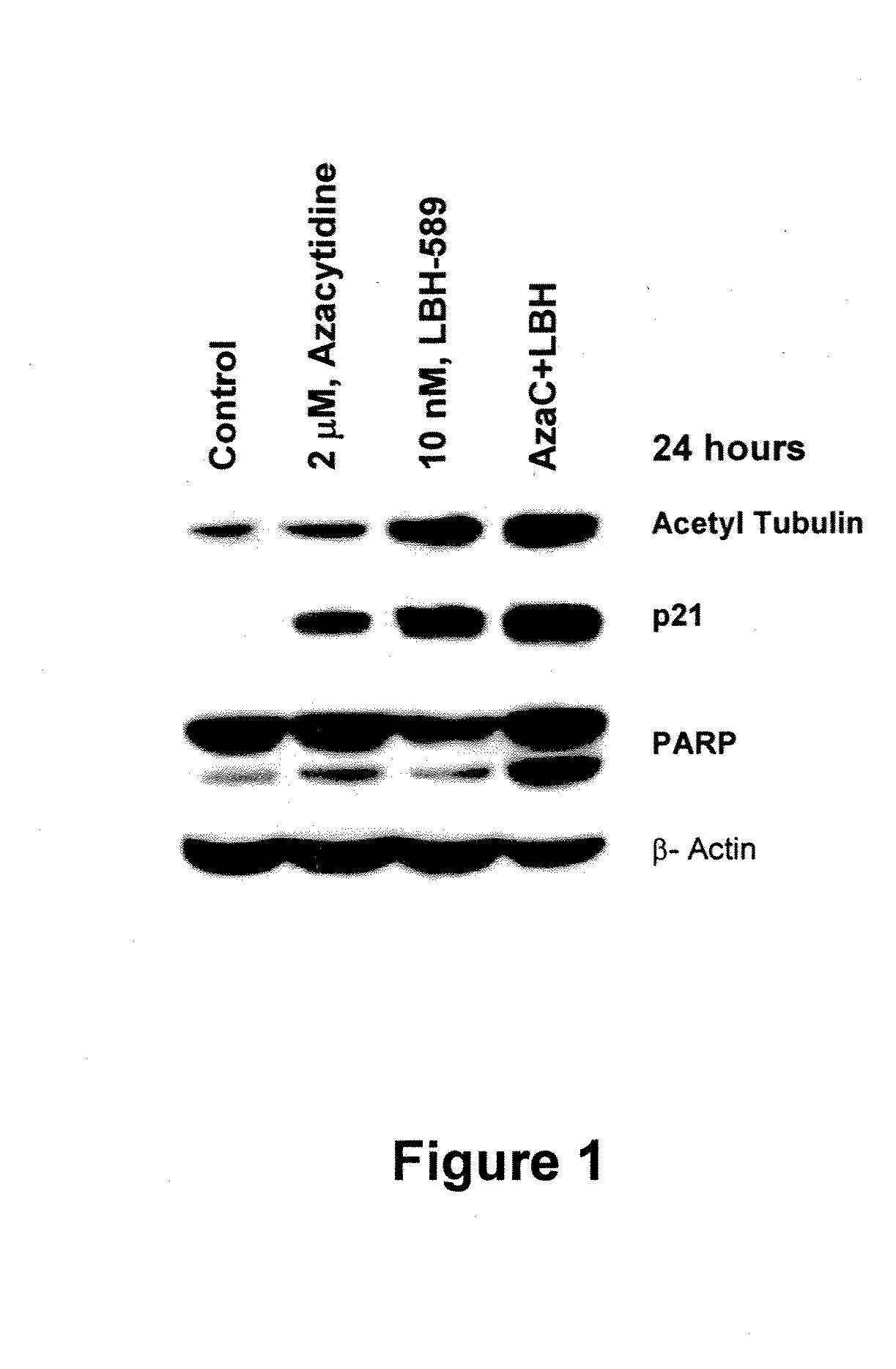 Combination of an HDAC inhibitor and an antimetabolite