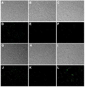 Tumor-targeted diagnosis nuclear magnetic resonance contrast agent and preparation method thereof