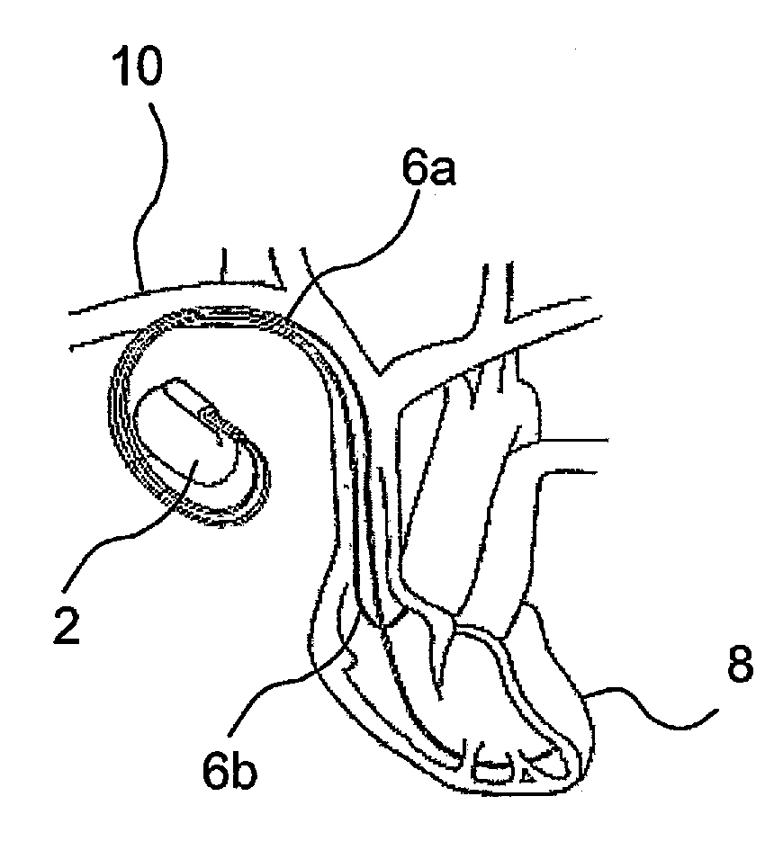 Implantable Medical Device with Therapy Control