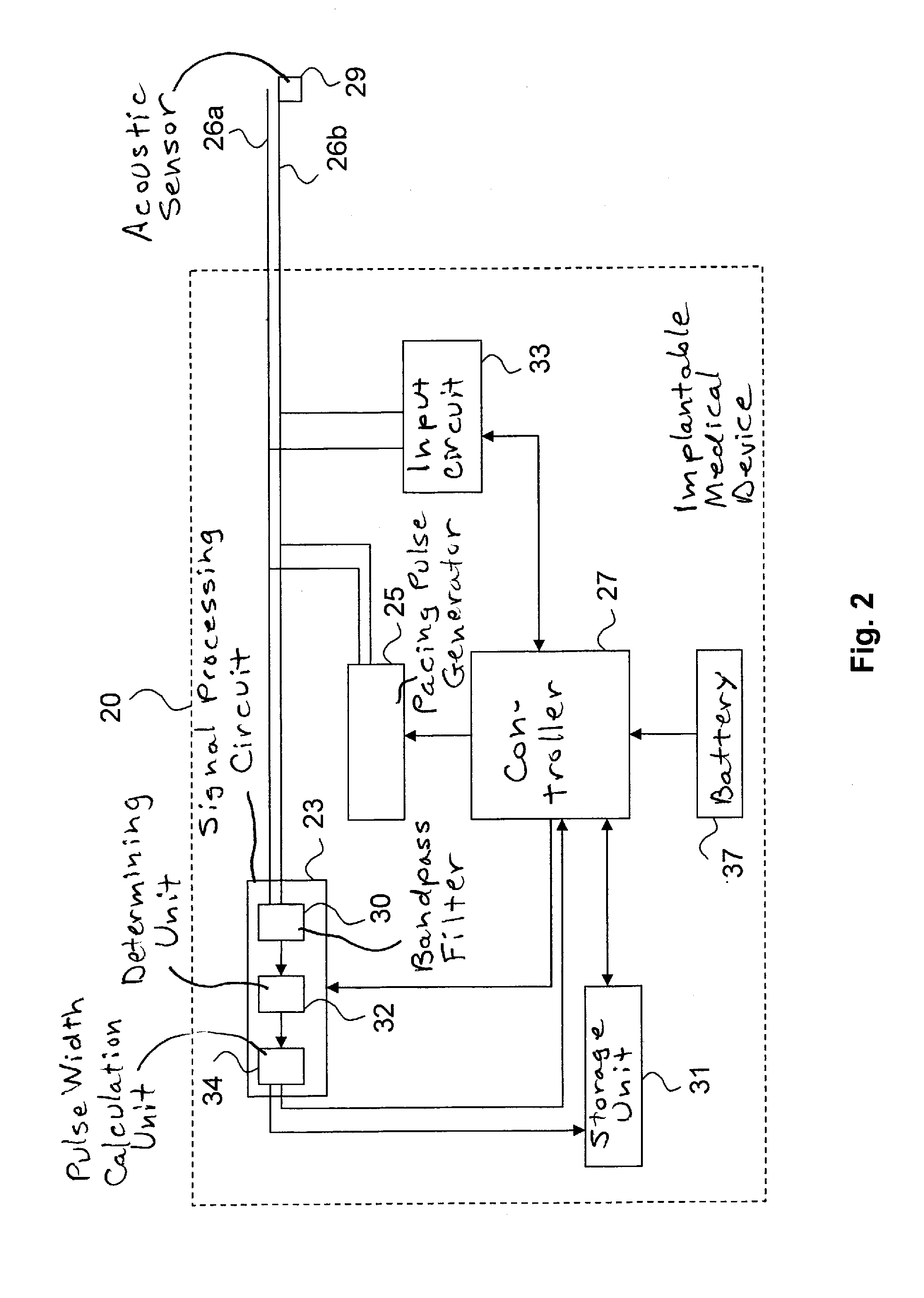 Implantable Medical Device with Therapy Control