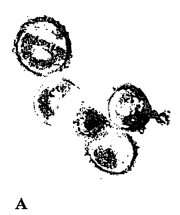 Method and composition for treatment and/or prevention of antibiotic-resistant microorganism infections