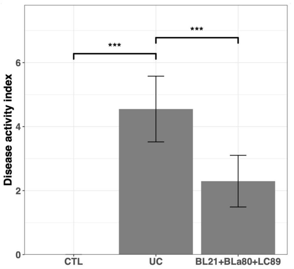 Compound probiotics capable of relieving ulcerative colitis, preparation method and application thereof