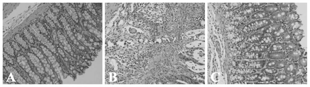 Compound probiotics capable of relieving ulcerative colitis, preparation method and application thereof